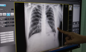 injury settlement