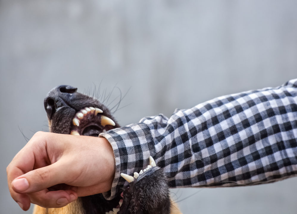 dog bite lawsuits