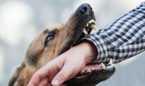 dog attack