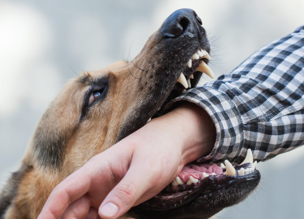 Dog bite attack results in serious injury.
